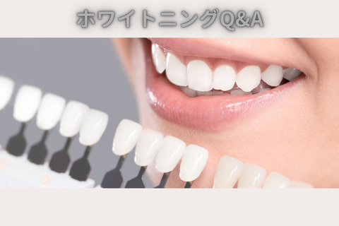 ホワイトニングQ&A：よくある質問にお答えします