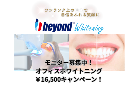 【限定モニター募集】憧れの白い歯を、特別価格で✨