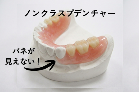 「それ、入れ歯？」と言わせない。ノンクラスプデンチャーで取り戻す、自然な笑顔と自信